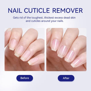 Nail Cuticle Remover 30ml Nail Care LILYCUTE 